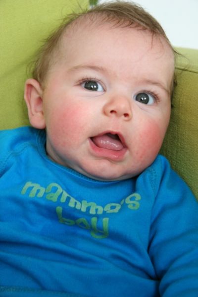 This is picture 1