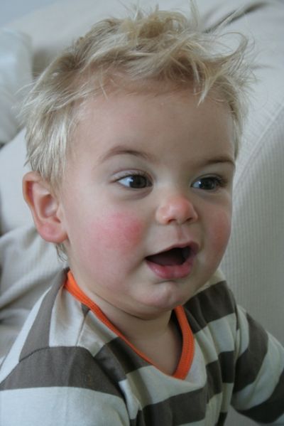 This is picture 1