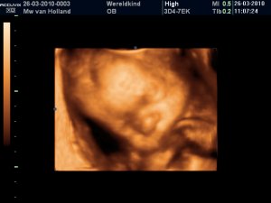 "Snurk....lekker knusjes en warm hiero..